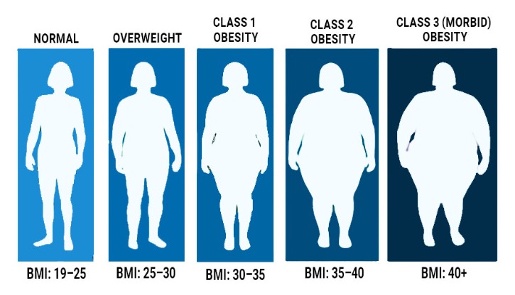 비만 있으면 치매 위험 증가…고혈압이 주요 위험 요인.jpg
